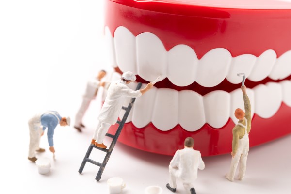 4 Reasons to Choose Professional Denture Repair - Lake Norman Dentistry Huntersville North Carolina